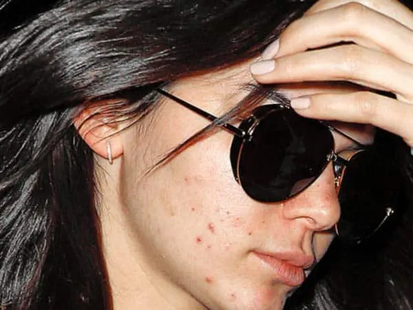 Kendall Jenner with no makeup